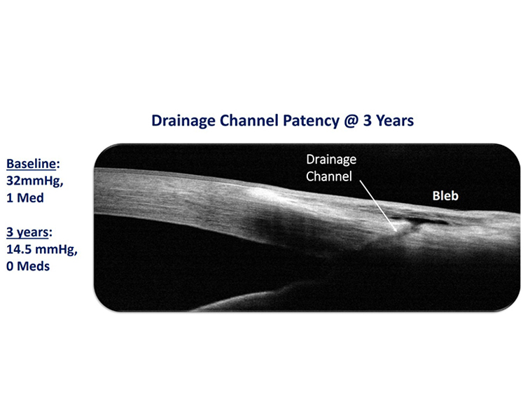 Channel Image